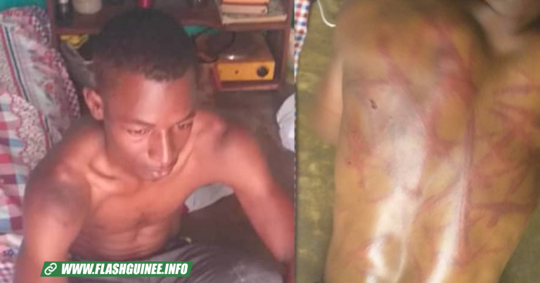 Le jeune sauvagement fouetté par des agents de sécurité, se confie :« gendarmes et policiers se sont tous… »