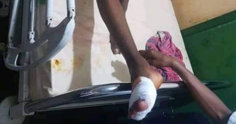 8Heures à Conakry : premier bilan de la marche du FNDC « fait état de deux (2) blessés par balles dont une femme qui a reçu la balle au niveau de son pieds »