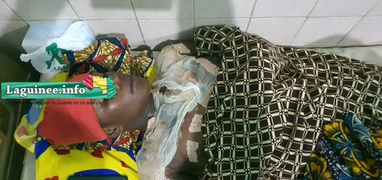 Mamou : à cause d’une tasse de thé, une femme verse de l’eau chaude sur sa coépouse à Thieougol